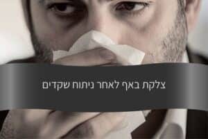 מאמר - צלקת באף לאחר ניתוח שקדים - עורך דין דורית פילו